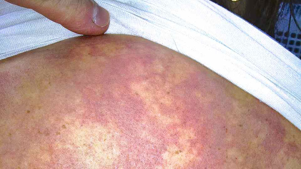 April: A Sample of Recent Asia-Pacific Diving&nbsp;Incidents